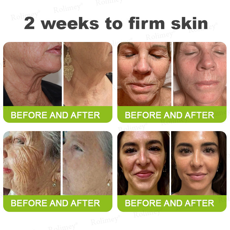 Frolunora® Botox & Vita A Retinol Shot Wrinkle - Lift Tightening cream