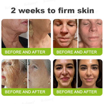 Frolunora® Botox & Vita A Retinol Shot Wrinkle - Lift Tightening cream