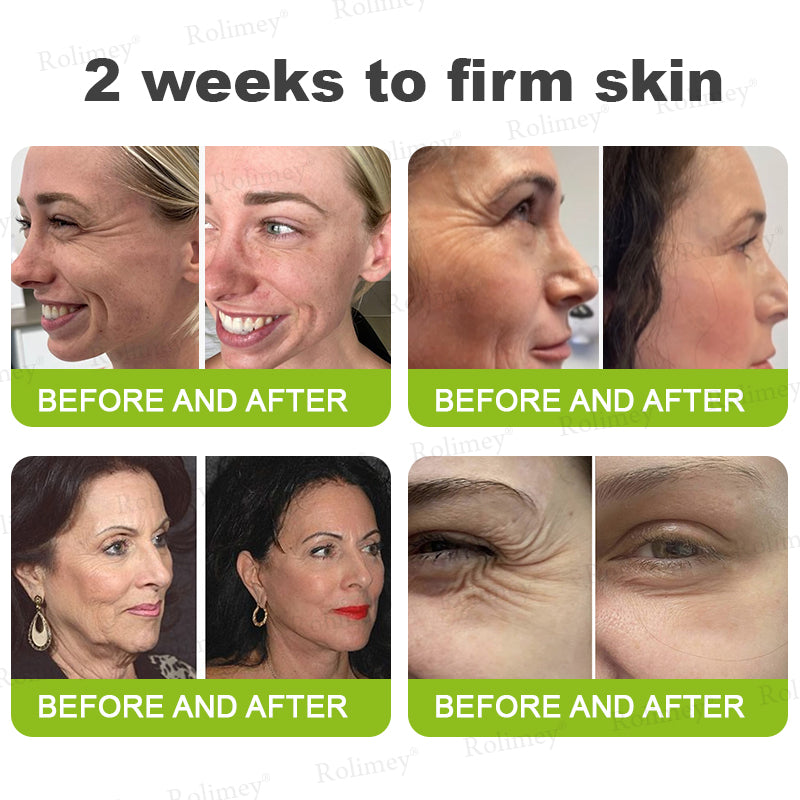 Frolunora® Botox & Vita A Retinol Shot Wrinkle - Lift Tightening cream