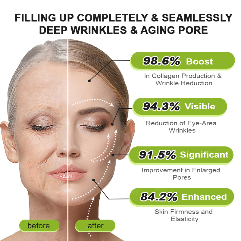 Frolunora® Botox & Vita A Retinol Shot Wrinkle - Lift Tightening cream