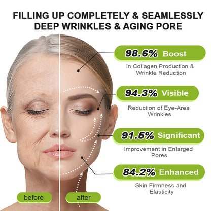 Frolunora® Botox & Vita A Retinol Shot Wrinkle - Lift Tightening cream