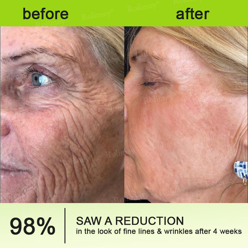 Frolunora® Botox & Vita A Retinol Shot Wrinkle - Lift Tightening cream