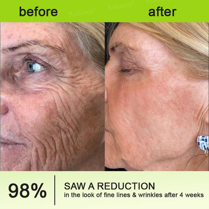 Frolunora® Botox & Vita A Retinol Shot Wrinkle - Lift Tightening cream