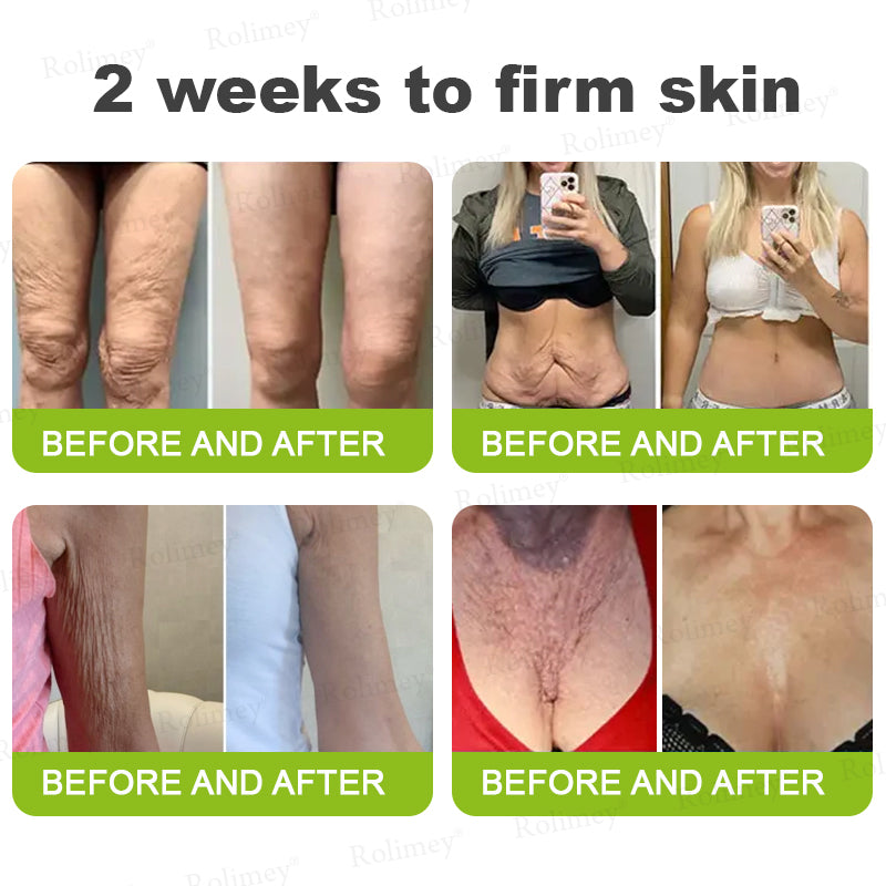 Frolunora® Botox & Vita A Retinol Shot Wrinkle - Lift Tightening cream