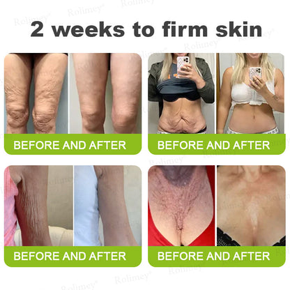 Frolunora® Botox & Vita A Retinol Shot Wrinkle - Lift Tightening cream